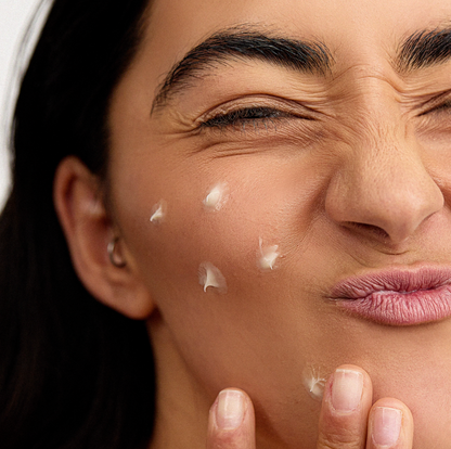 Inskin Co - Blemish Control Cream